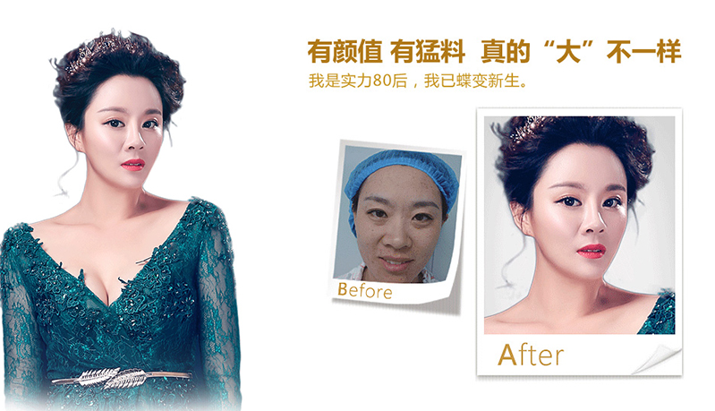 六盘水脂肪移植、隆鼻