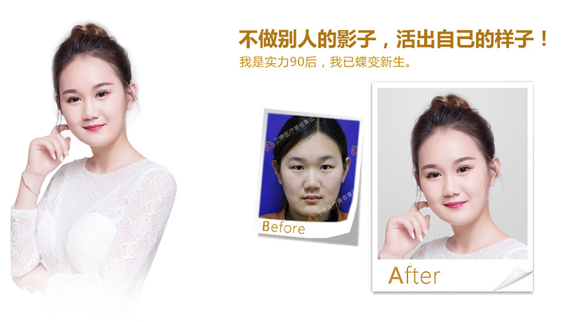 六盘水纳米脂肪移植