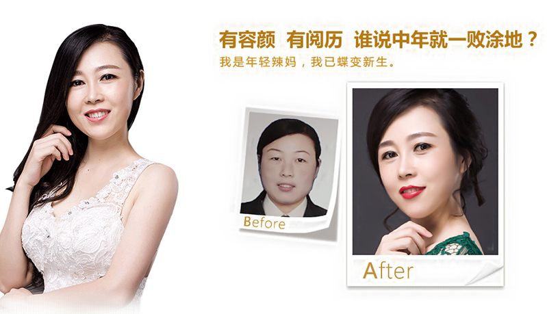 六盘水5D童颜术