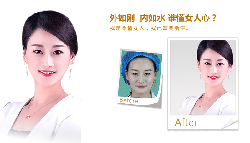 六盘水V脸、线雕隆鼻